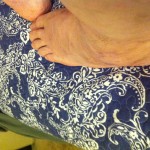 swollen left foot